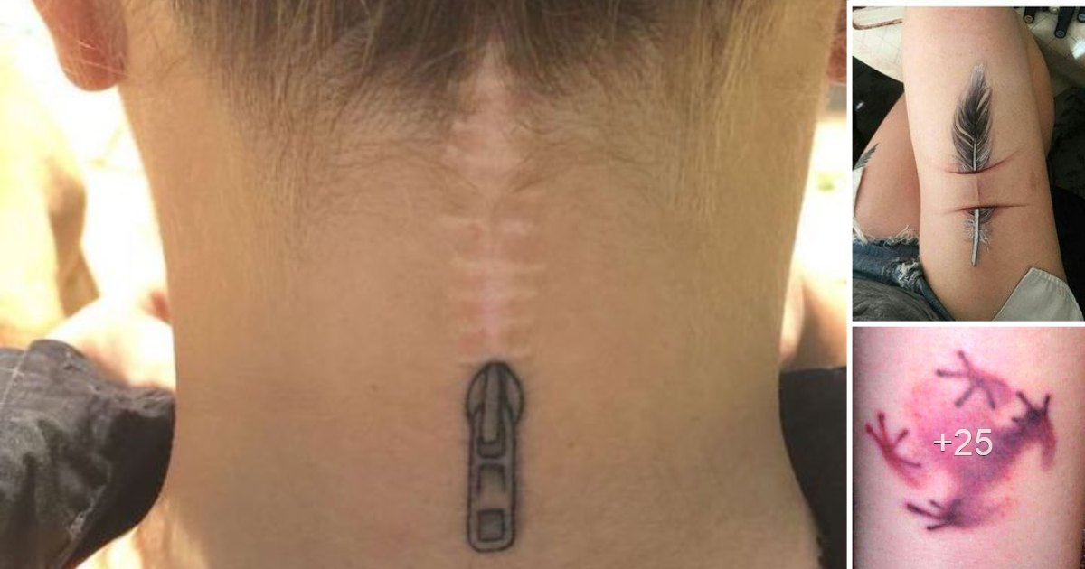 En este momento estás viendo Creativos Diseños de Tatuajes para Esconder Cicatrices